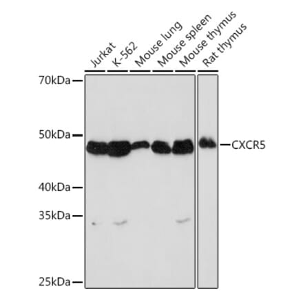 Western Blot - Anti-CXCR5 Antibody [ARC1363] (A308772) - Antibodies.com