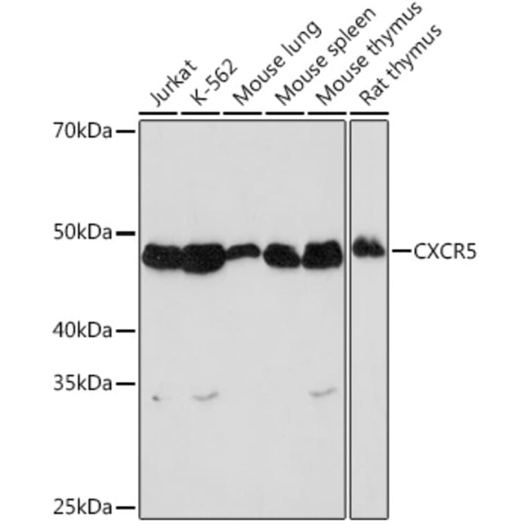 Western Blot - Anti-CXCR5 Antibody [ARC1363] (A308772) - Antibodies.com