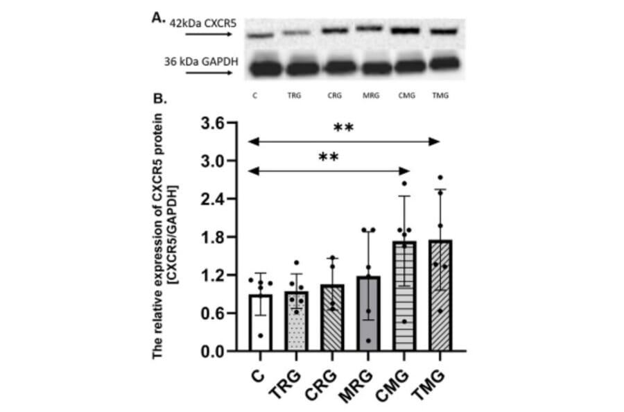 Western Blot - Anti-CXCR5 Antibody [ARC1363] - Antibodies.com