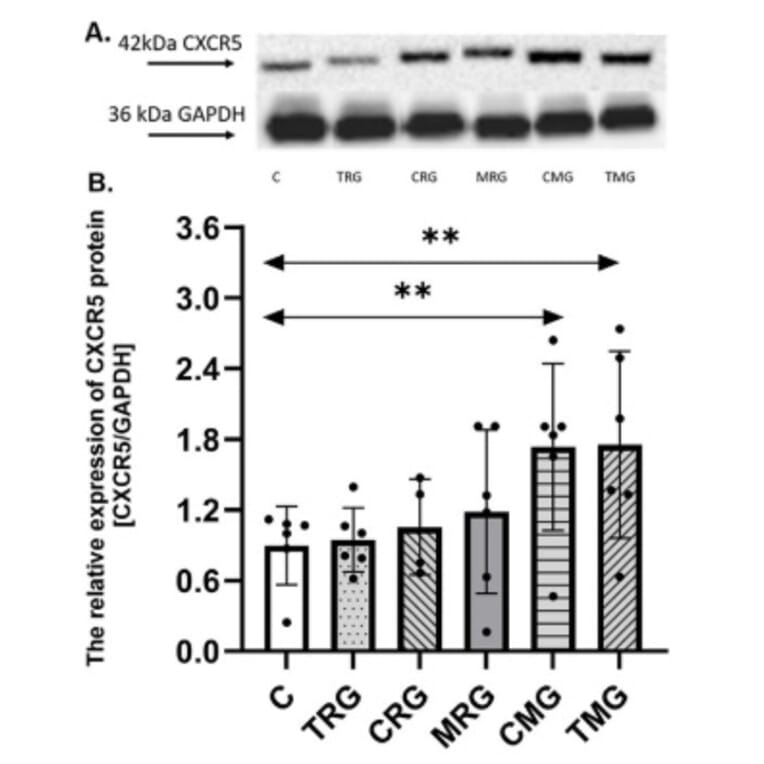 Western Blot - Anti-CXCR5 Antibody [ARC1363] - Antibodies.com
