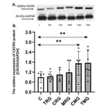 Western Blot - Anti-CXCR5 Antibody [ARC1363] - Antibodies.com