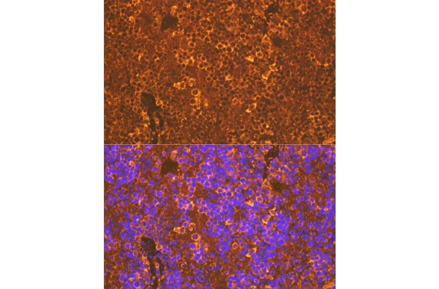 Immunofluorescence - Anti-CXCR5 Antibody [ARC1363] (A308772) - Antibodies.com