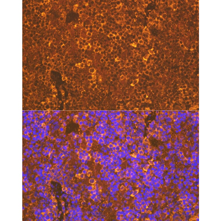 Immunofluorescence - Anti-CXCR5 Antibody [ARC1363] (A308772) - Antibodies.com