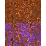 Immunofluorescence - Anti-CXCR5 Antibody [ARC1363] (A308772) - Antibodies.com