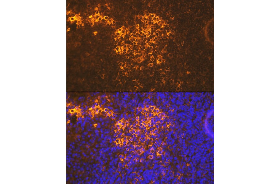 IHC - Anti-CXCR5 Antibody [ARC1363] (A308772)