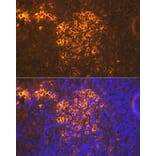 Immunofluorescence - Anti-CXCR5 Antibody [ARC1363] (A308772) - Antibodies.com