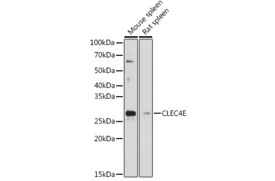 Western Blot - Anti-CLEC4E / MINCLE Antibody (A308773) - Antibodies.com