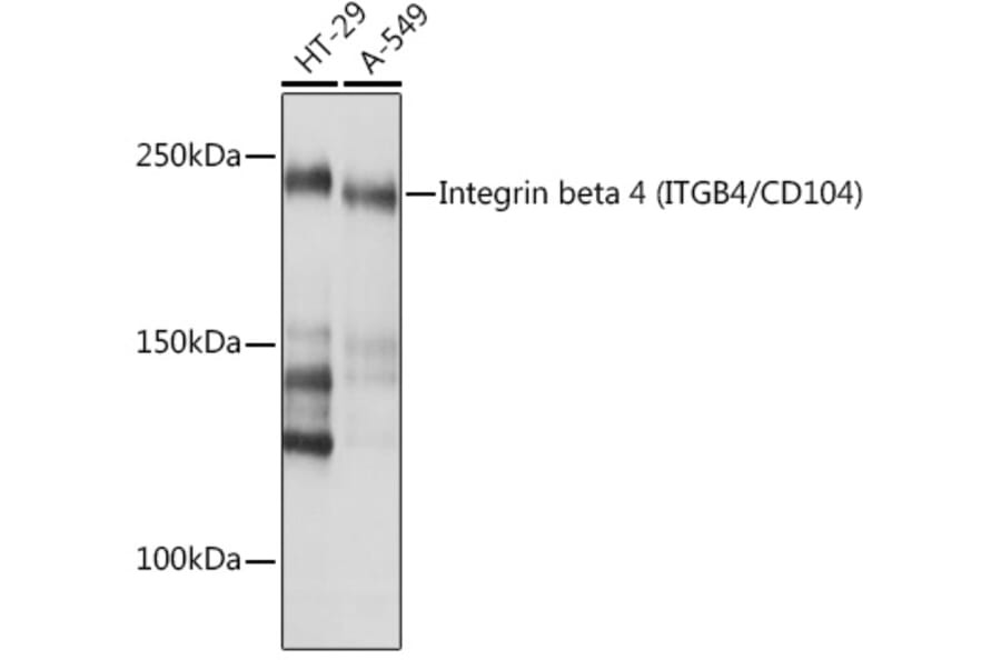 Western Blot - Anti-Integrin beta 4 Antibody [ARC1046] (A308774) - Antibodies.com