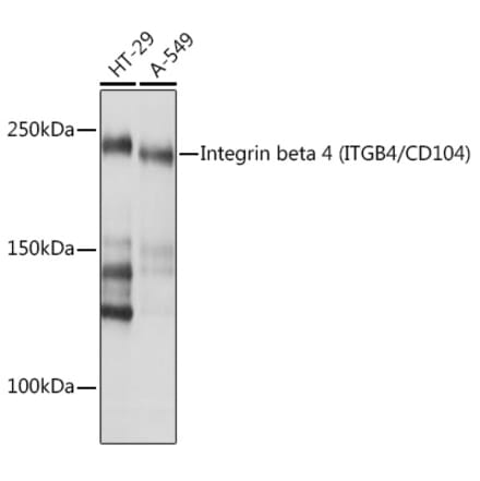 Western Blot - Anti-Integrin beta 4 Antibody [ARC1046] (A308774) - Antibodies.com