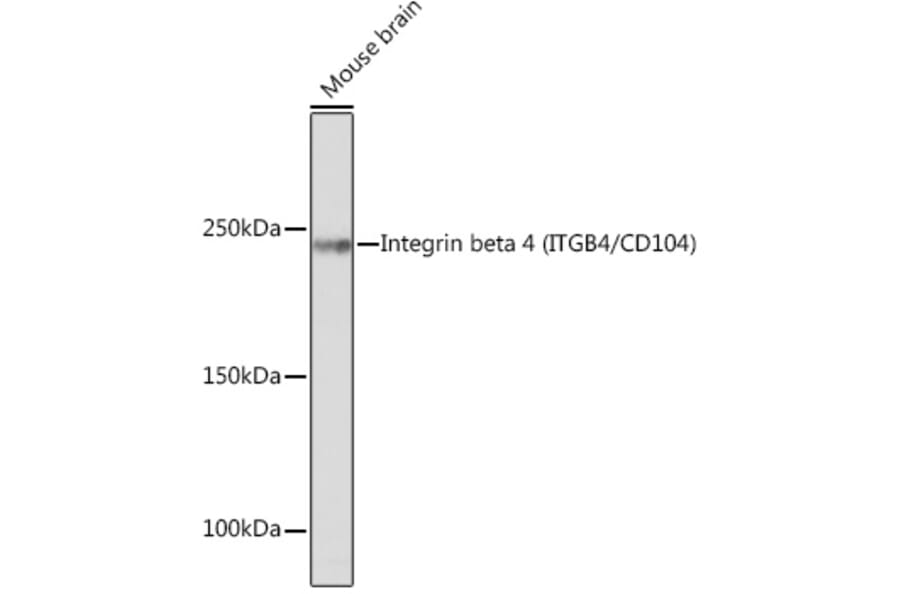 Western Blot - Anti-Integrin beta 4 Antibody [ARC1046] (A308774) - Antibodies.com