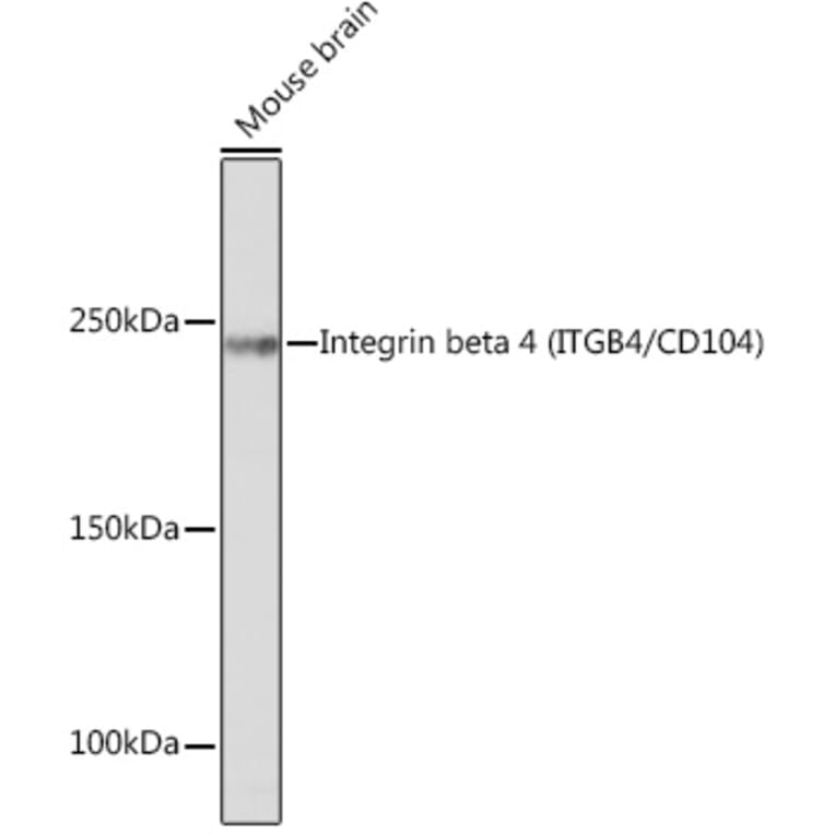Western Blot - Anti-Integrin beta 4 Antibody [ARC1046] (A308774) - Antibodies.com