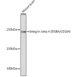 Western Blot - Anti-Integrin beta 4 Antibody [ARC1046] (A308774) - Antibodies.com