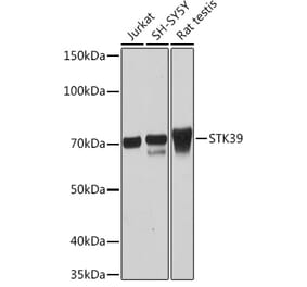 Western Blot - Anti-SPAK Antibody [ARC1896] (A308775) - Antibodies.com