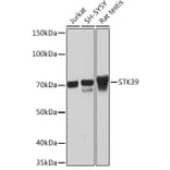 Western Blot - Anti-SPAK Antibody [ARC1896] (A308775) - Antibodies.com