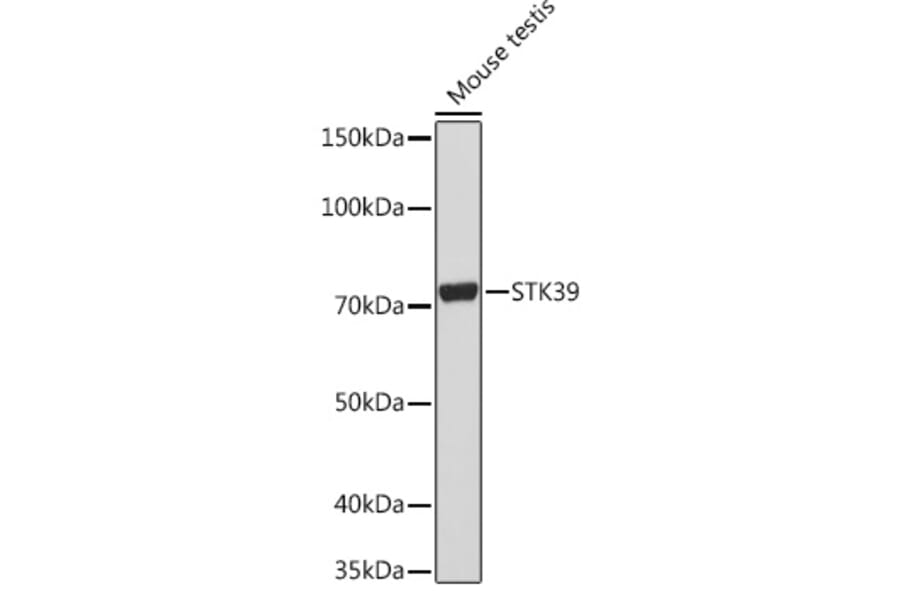 Western Blot - Anti-SPAK Antibody [ARC1896] (A308775) - Antibodies.com