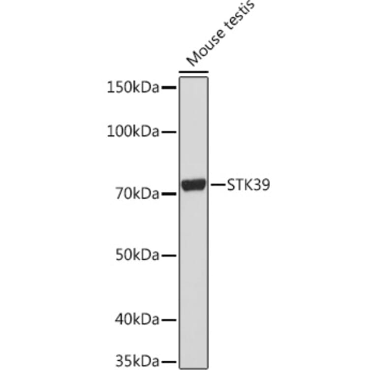 Western Blot - Anti-SPAK Antibody [ARC1896] (A308775) - Antibodies.com
