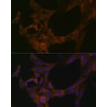 Immunofluorescence - Anti-SPAK Antibody [ARC1896] (A308775) - Antibodies.com