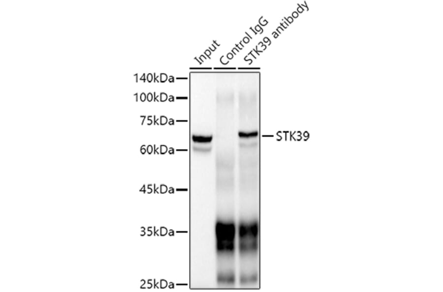 Western Blot - Anti-SPAK Antibody [ARC1896] (A308775) - Antibodies.com