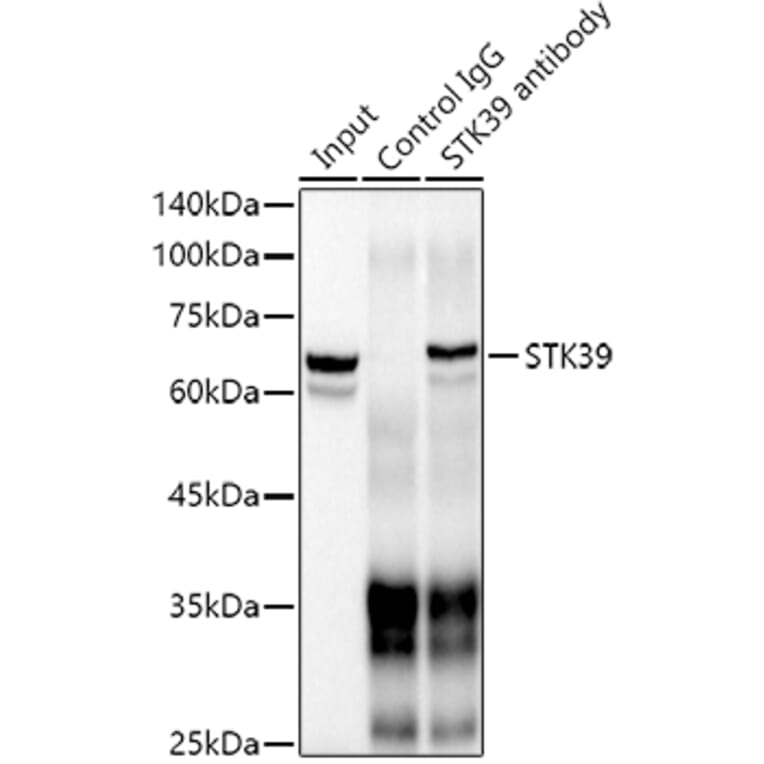 Western Blot - Anti-SPAK Antibody [ARC1896] (A308775) - Antibodies.com