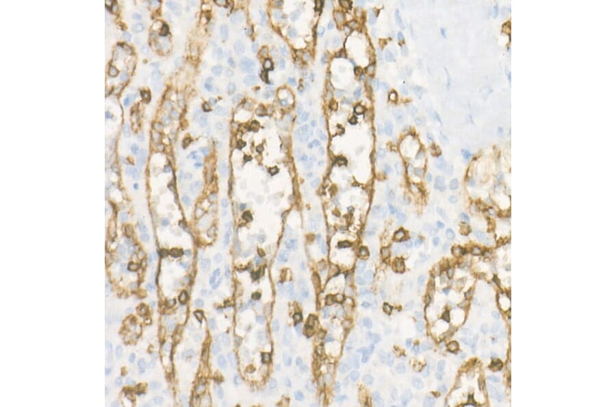 Immunohistochemistry - Anti-CD8 alpha Antibody [ARC55249] (A308777) - Antibodies.com
