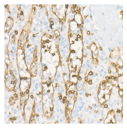 Immunohistochemistry - Anti-CD8 alpha Antibody [ARC55249] (A308777) - Antibodies.com