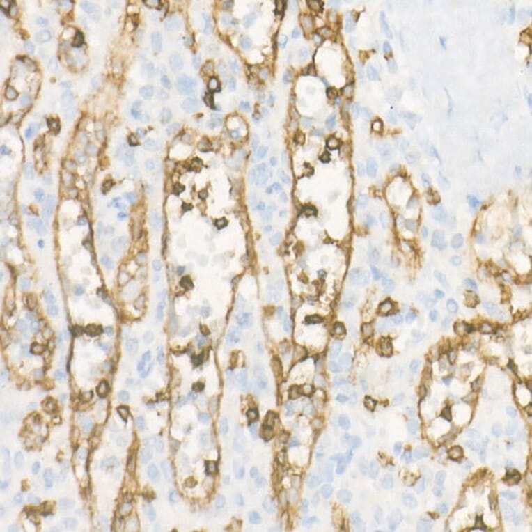 Immunohistochemistry - Anti-CD8 alpha Antibody [ARC55249] (A308777) - Antibodies.com