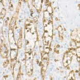 Immunohistochemistry - Anti-CD8 alpha Antibody [ARC55249] (A308777) - Antibodies.com