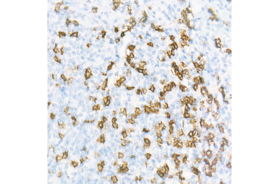 Immunohistochemistry - Anti-CD8 alpha Antibody [ARC55249] (A308777) - Antibodies.com
