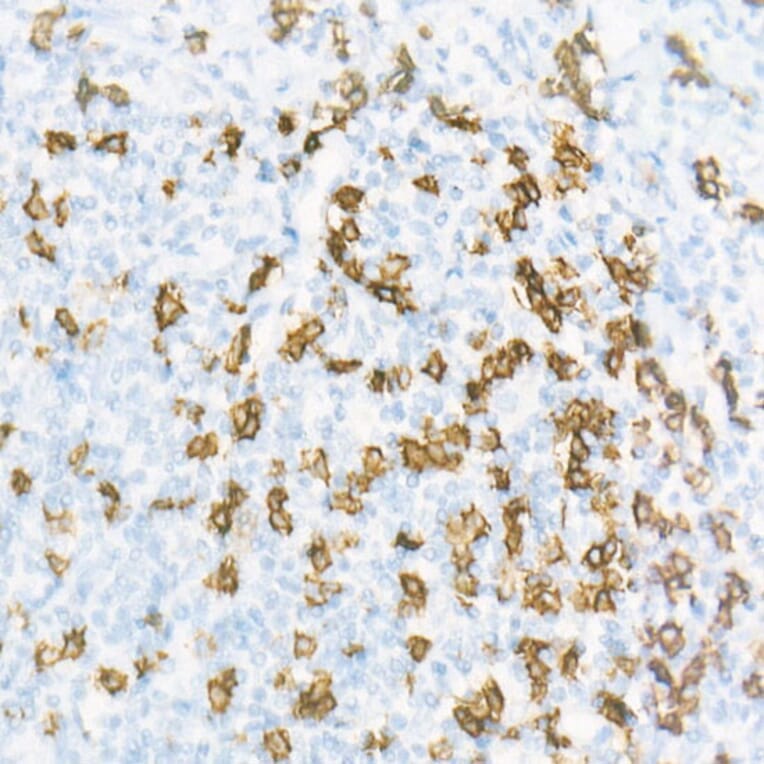 Immunohistochemistry - Anti-CD8 alpha Antibody [ARC55249] (A308777) - Antibodies.com
