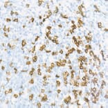 Immunohistochemistry - Anti-CD8 alpha Antibody [ARC55249] (A308777) - Antibodies.com
