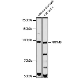 Western Blot - Anti-PRDM9 Antibody (A308778) - Antibodies.com