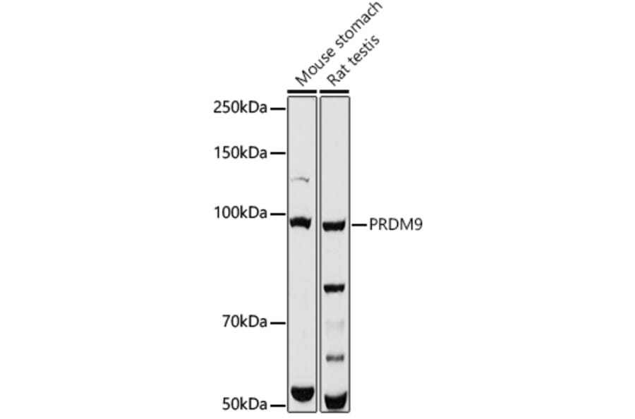Western Blot - Anti-PRDM9 Antibody (A308778) - Antibodies.com