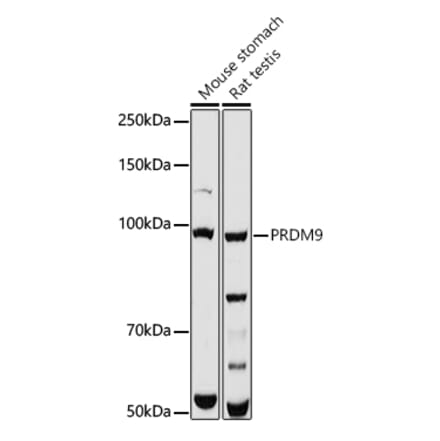Western Blot - Anti-PRDM9 Antibody (A308778) - Antibodies.com