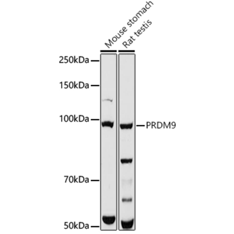 Western Blot - Anti-PRDM9 Antibody (A308778) - Antibodies.com