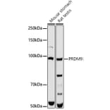 Western Blot - Anti-PRDM9 Antibody (A308778) - Antibodies.com