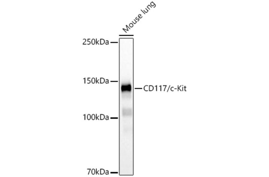 Western Blot - Anti-c-Kit Antibody [ARC60558] (A308779) - Antibodies.com