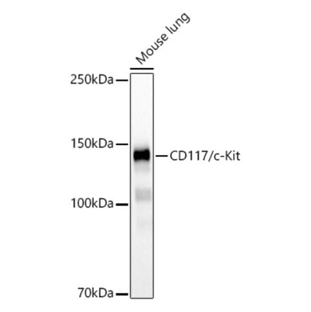 Western Blot - Anti-c-Kit Antibody [ARC60558] (A308779) - Antibodies.com
