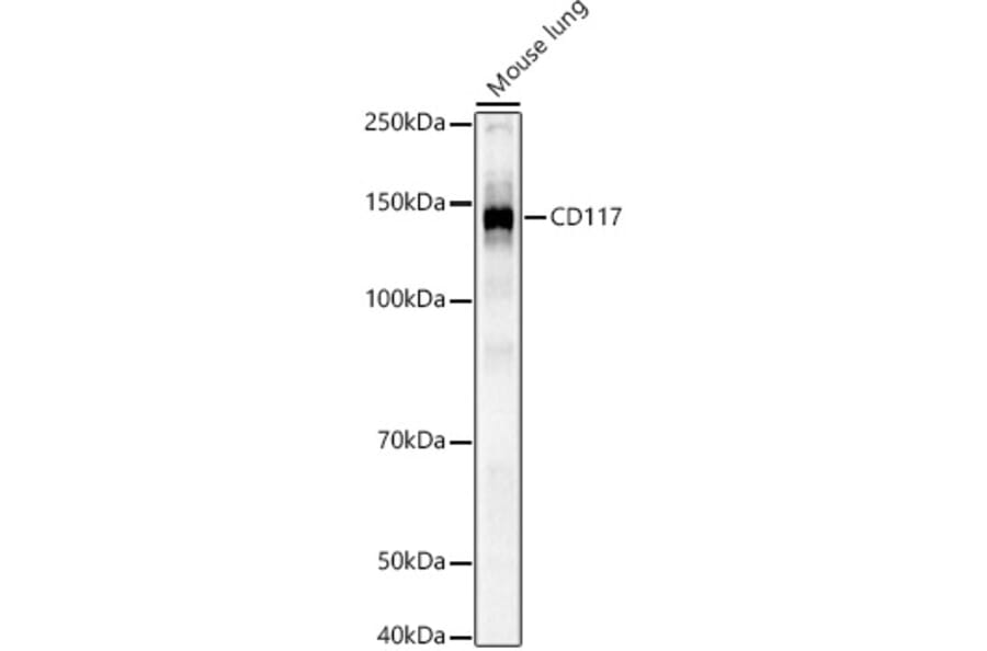Western Blot - Anti-c-Kit Antibody (A308780) - Antibodies.com