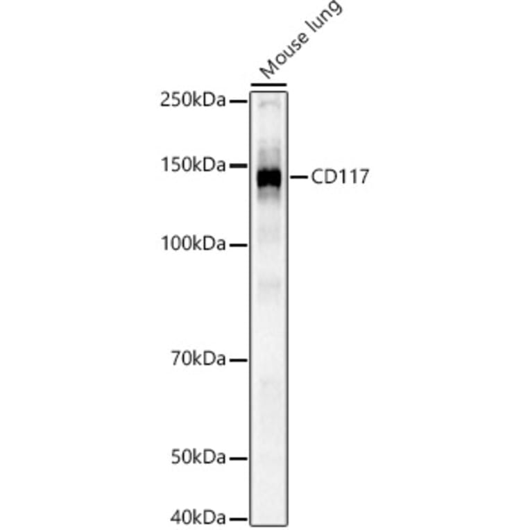 Western Blot - Anti-c-Kit Antibody (A308780) - Antibodies.com