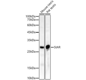 Western Blot - Anti-StAR Antibody [ARC55812] (A308782) - Antibodies.com