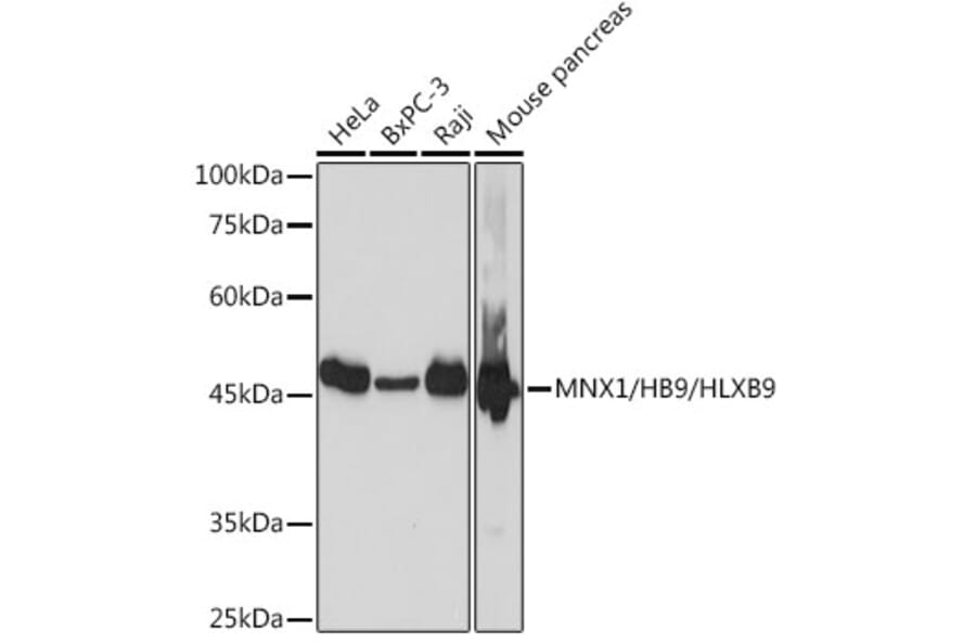 Western Blot - Anti-HB9/HLXB9/MNX1 Antibody [ARC2233] (A308783) - Antibodies.com