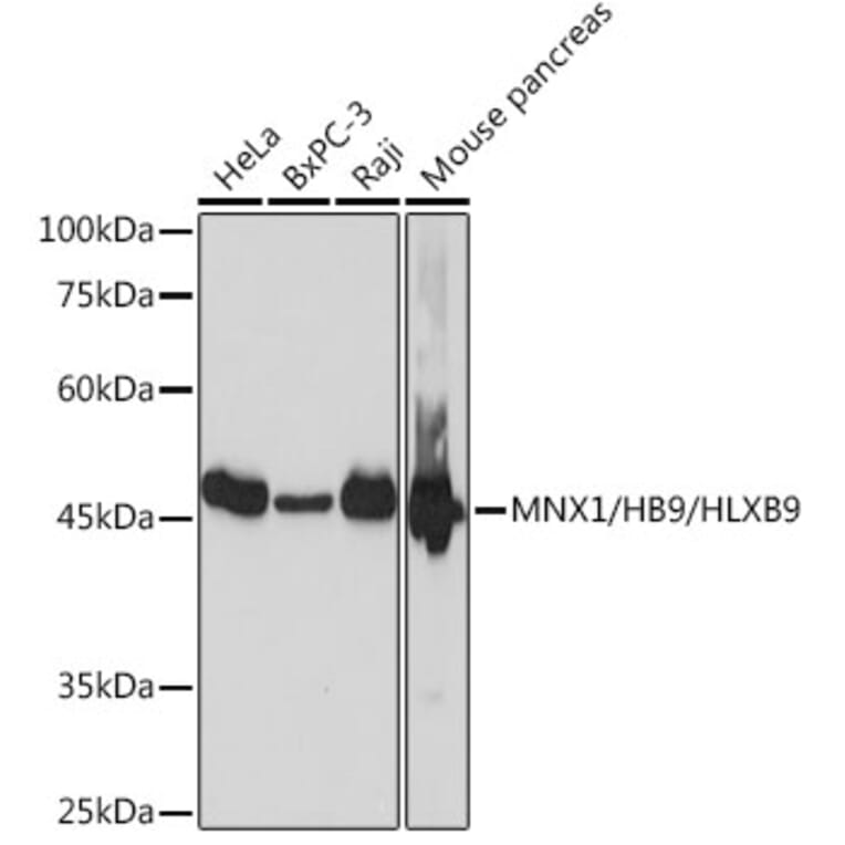 Western Blot - Anti-HB9/HLXB9/MNX1 Antibody [ARC2233] (A308783) - Antibodies.com