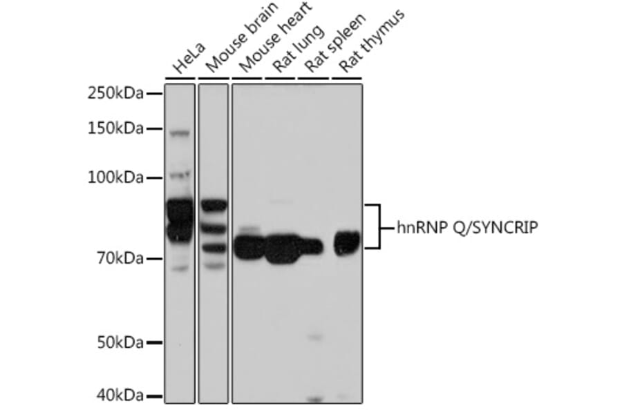 Western Blot - Anti-hnRNP Q Antibody [ARC1656] (A308784) - Antibodies.com