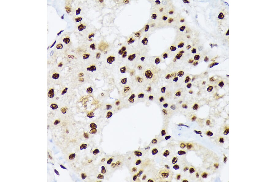 Immunohistochemistry - Anti-hnRNP Q Antibody [ARC1656] (A308784) - Antibodies.com