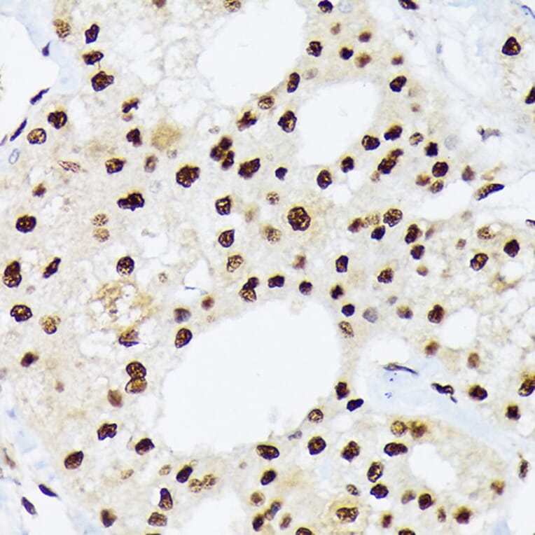 Immunohistochemistry - Anti-hnRNP Q Antibody [ARC1656] (A308784) - Antibodies.com