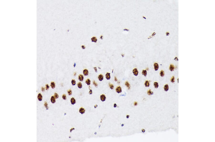 Immunohistochemistry - Anti-hnRNP Q Antibody [ARC1656] (A308784) - Antibodies.com