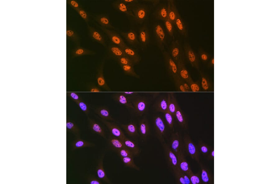 Immunofluorescence - Anti-hnRNP Q Antibody [ARC1656] (A308784) - Antibodies.com