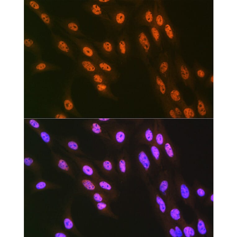 Immunofluorescence - Anti-hnRNP Q Antibody [ARC1656] (A308784) - Antibodies.com
