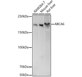 Western Blot - Anti-ABCA6 Antibody (A308785) - Antibodies.com