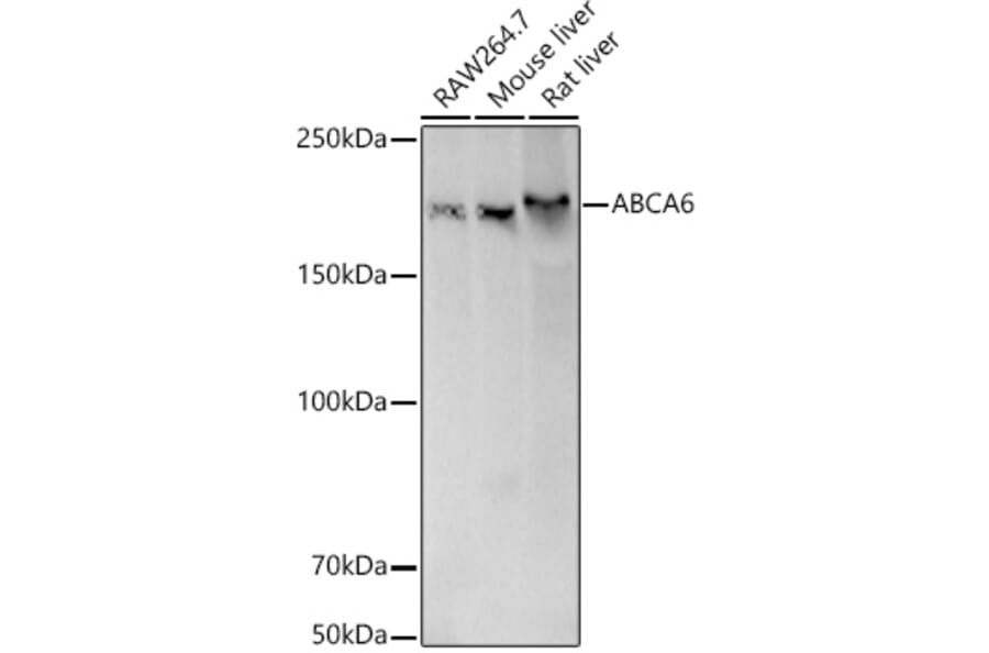 Western Blot - Anti-ABCA6 Antibody (A308785) - Antibodies.com